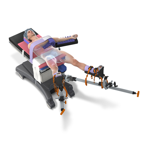 Hip Procedures