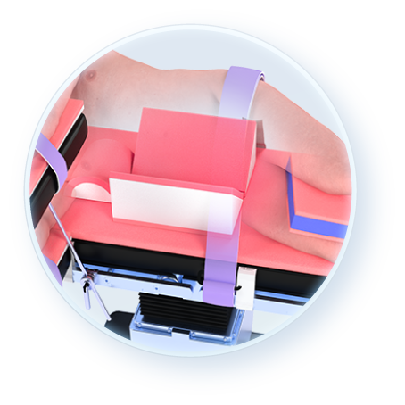 Minimally Invasive Support