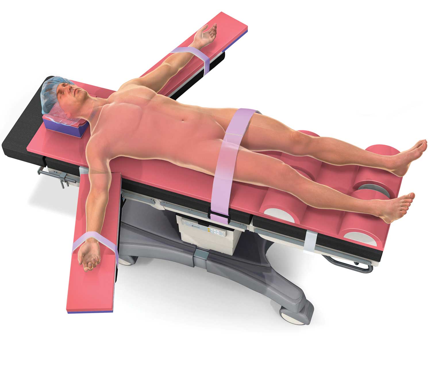 Supine Position Example