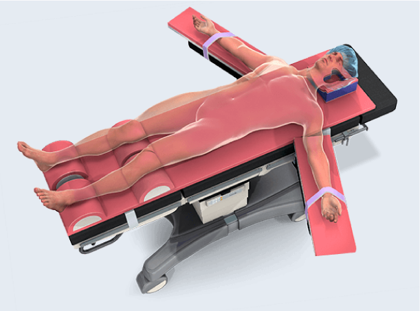 The Pink Hip Kit - Postless Hip Positioning System by Xodus Medical