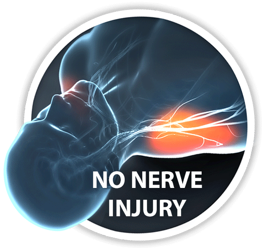 No nerve injury