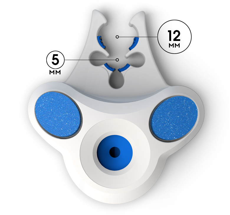 The See Sharp by Xodus Medical